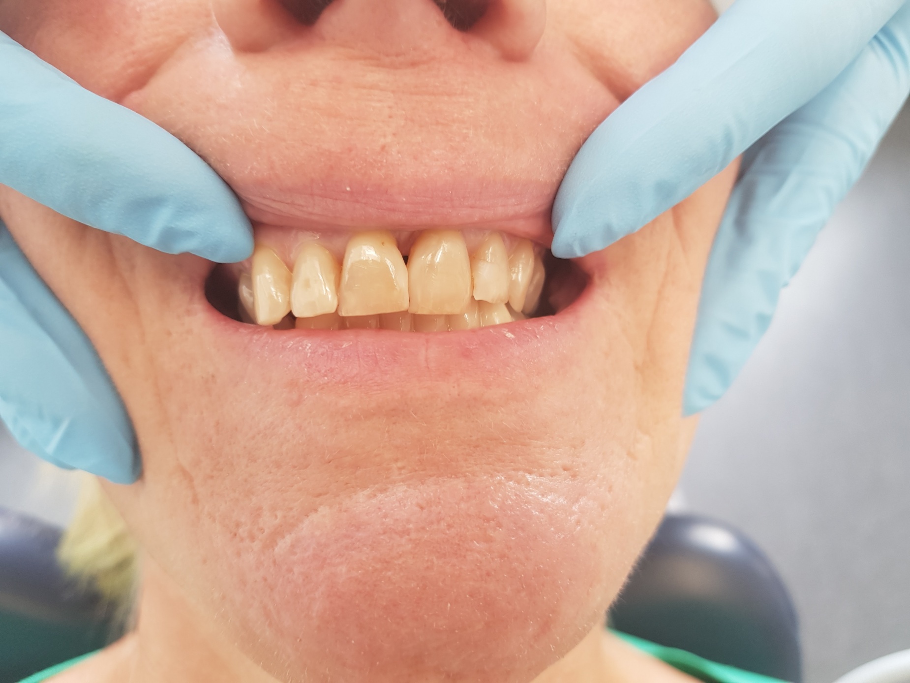 Mooie tanden zorgen wij voor - verschillende cases